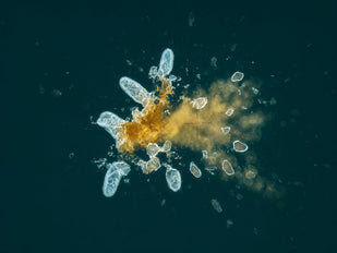What Comes Apart, Leaves
